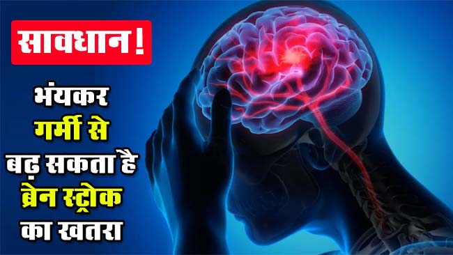 Brain Stroke: सावधान! भंयकर गर्मी से बढ़ सकता है ब्रेन स्ट्रोक का खतरा, डॉक्टरों ने चेतावनी दी